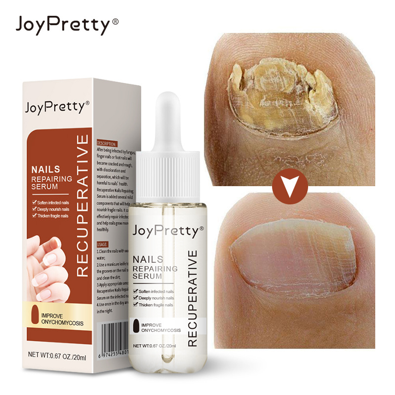 Wholesale Softening Cuticle Nail Growth Serum Cuticle Revitalizer Oil Nail Repairing Serum