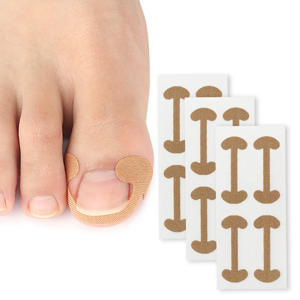 Pedicure Corrector Patch and Nail Correction Tool and Painless Corrector