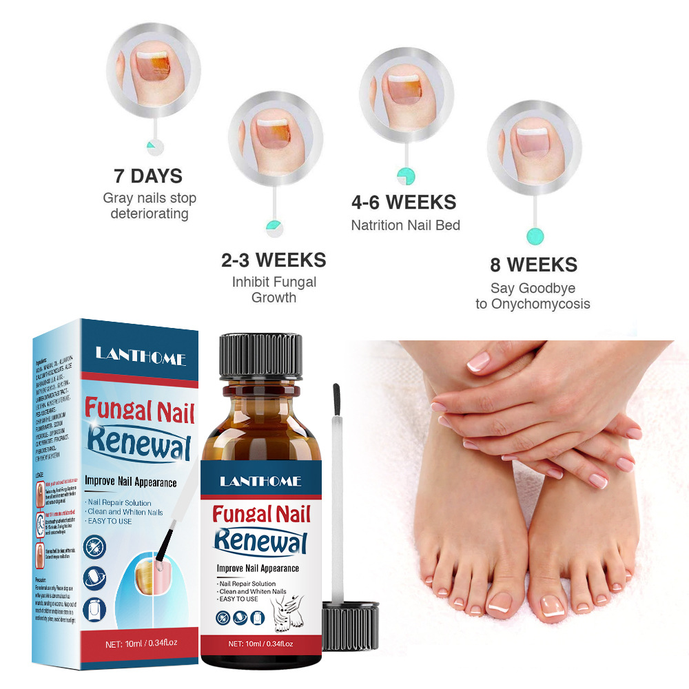 LANTHOME Natural Nail Repair Liquid Gentle Care Anti Fungal Nail