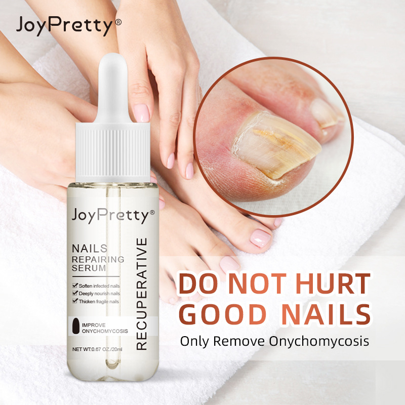 Wholesale Softening Cuticle Nail Growth Serum Cuticle Revitalizer Oil Nail Repairing Serum
