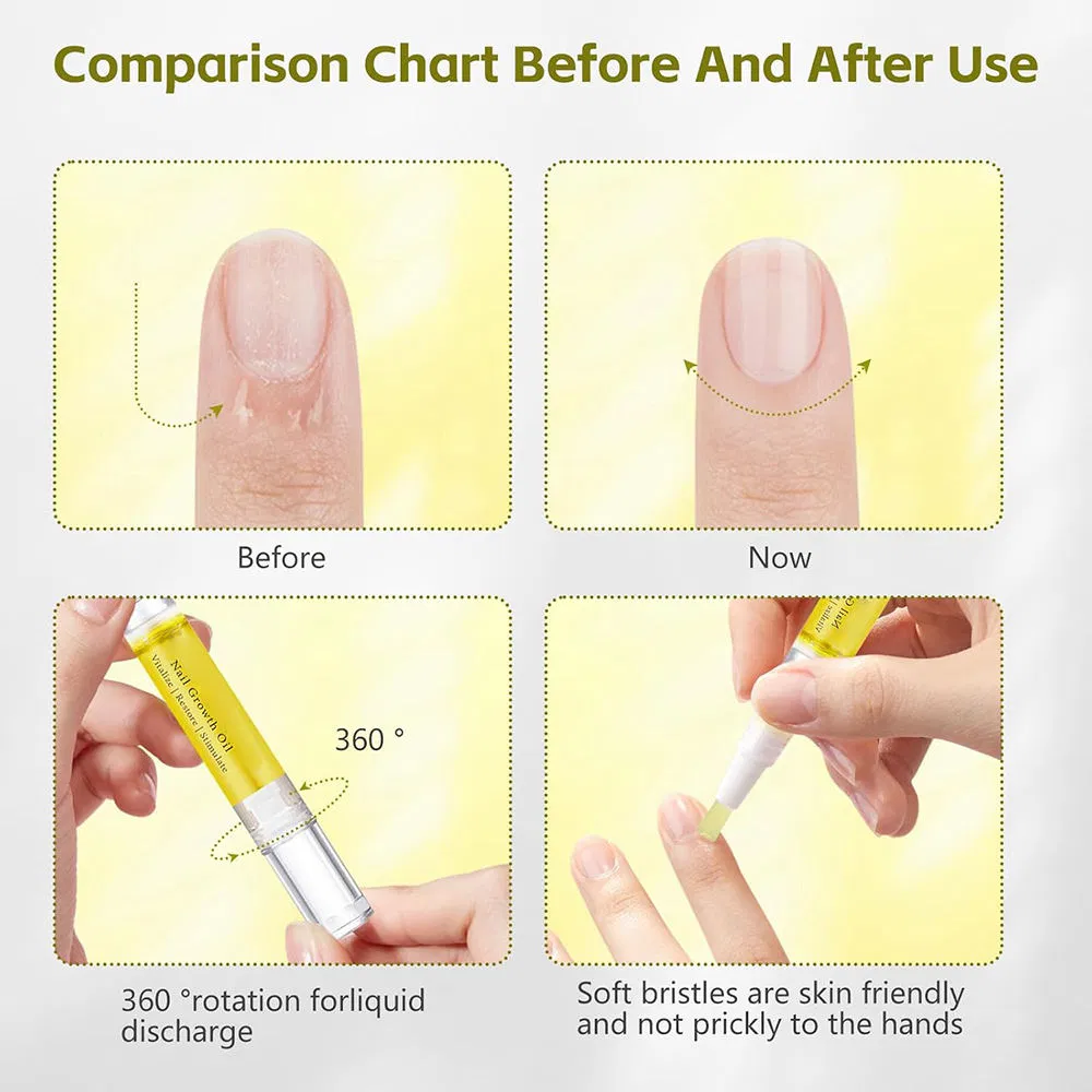 Vegan Nail Growth Oil Serum Moisturizing Strengthening Cuticle Oil for Nail Health