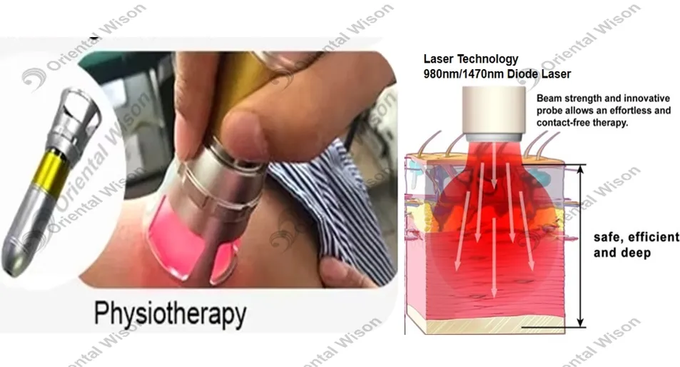 Physiotherapy-Pain Relief