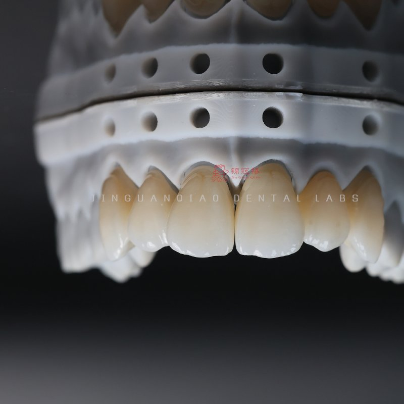 International Standard Monolithic Zirconia Crowns Chinese Dental Lab with High Aesthetic Quality for Oral Recovery