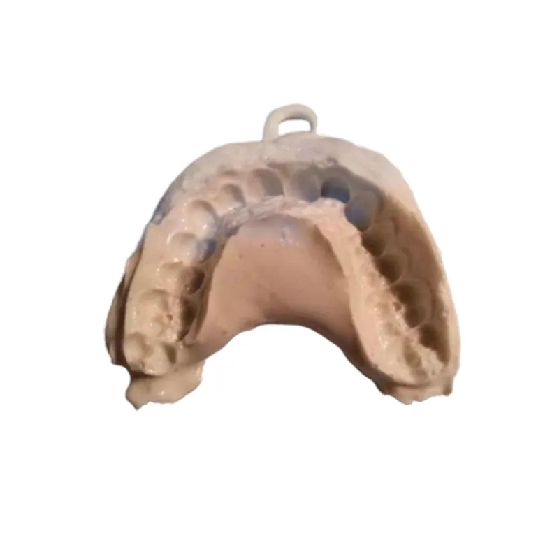 Customized Implant Teeth