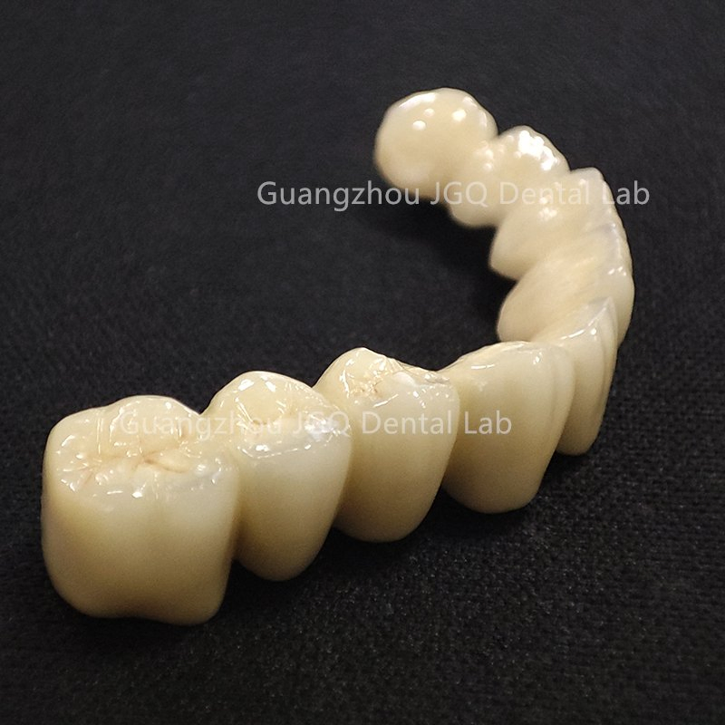 FDA CE Approved China Dental Lab Custom Co-Cr Full Arch Metal Bridge Crowns 3D Printing