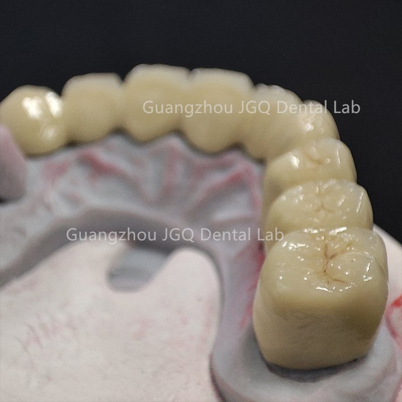 FDA CE Approved China Dental Lab Custom Co-Cr Full Arch Metal Bridge Crowns 3D Printing