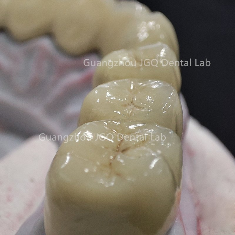 FDA CE Approved China Dental Lab Custom Co-Cr Full Arch Metal Bridge Crowns 3D Printing