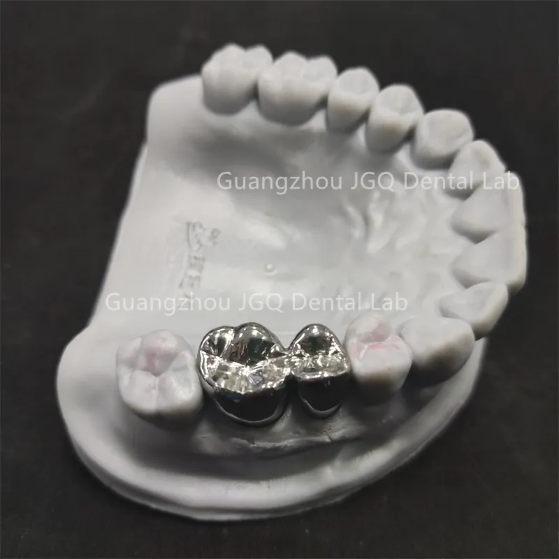 Custom Titanium Alloy Metal Crowns