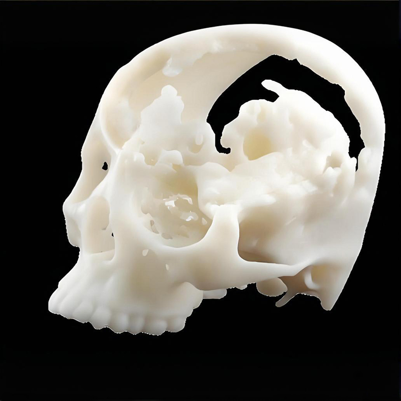 Custom SLA 3D Printing Vacuum Casting Rapid Prototype Service for Medical Model