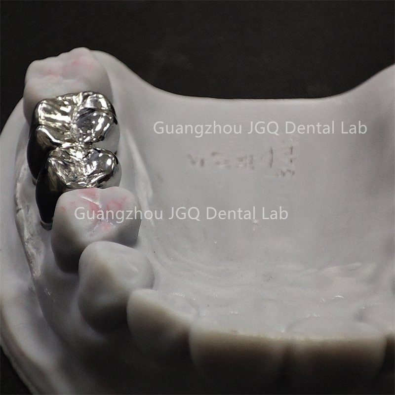 Full Service Dental Lab Custom Titanium Alloy Metal Crowns 3D Printing Best Affordable Price