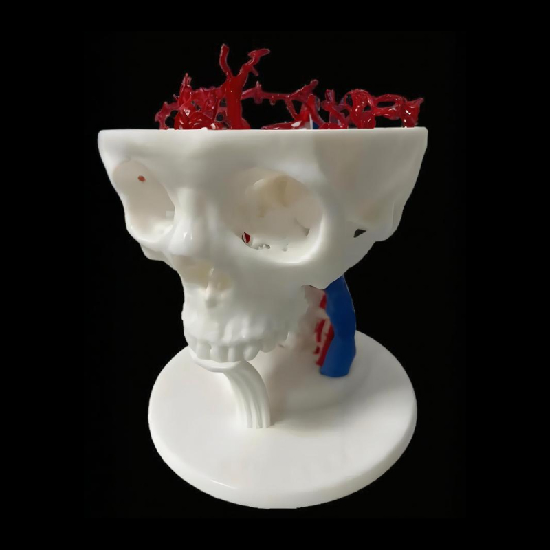 Custom SLA 3D Printing Vacuum Casting Rapid Prototype Service for Medical Model