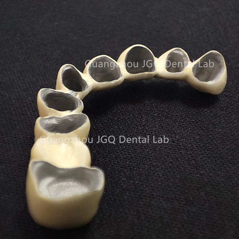 FDA CE Approved China Dental Lab Custom Co-Cr Full Arch Metal Bridge Crowns 3D Printing