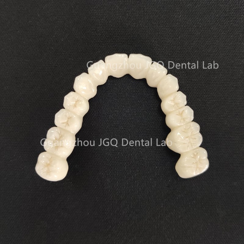 FDA CE Approved China Dental Lab Custom Co-Cr Full Arch Metal Bridge Crowns 3D Printing