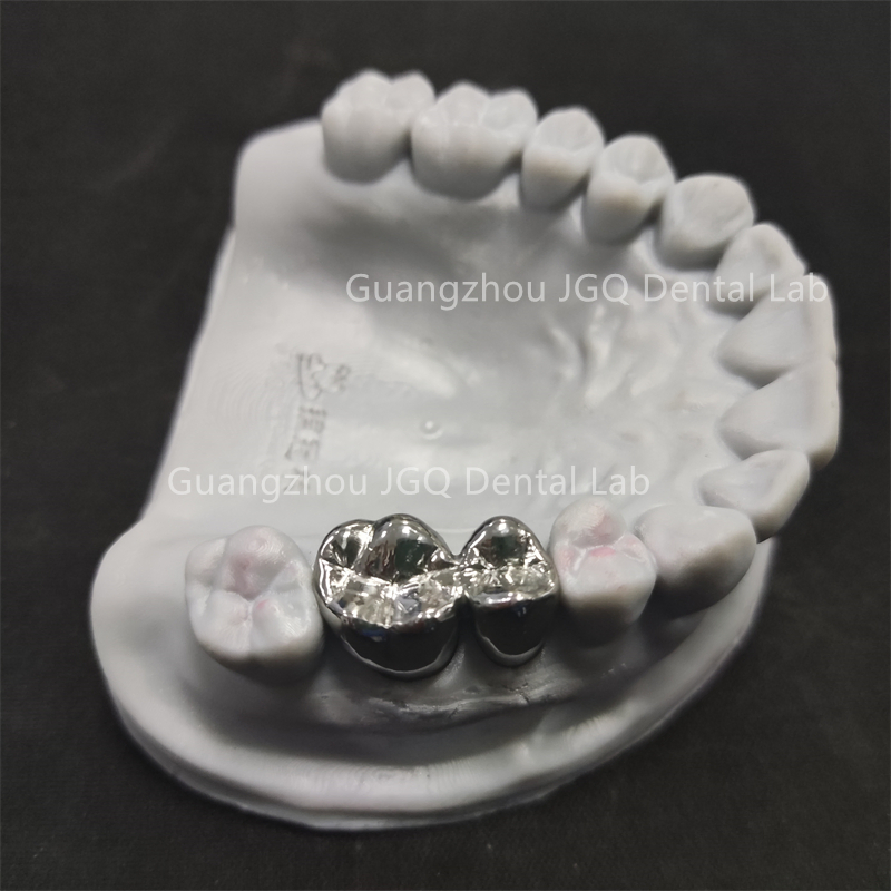 Full Service Dental Lab Custom Titanium Alloy Metal Crowns 3D Printing Best Affordable Price