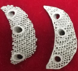 Total Hip Replacement for Osteoarthritis Secondary to Hip Dysplasia