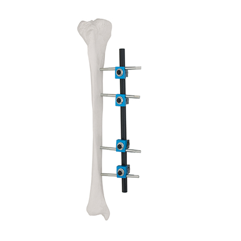 Ao Design Combination Ztype External Fixator for Femur &Tibia