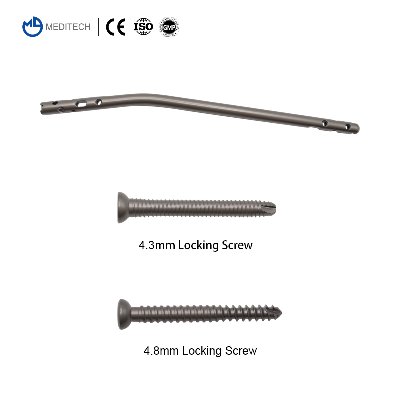 Direct Sale Orthopedic Implant Titanium Expert Tibia Interlocking Intramedullary Nail