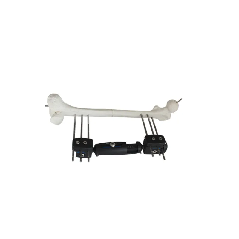 Orthopedic Fixator Detail 3