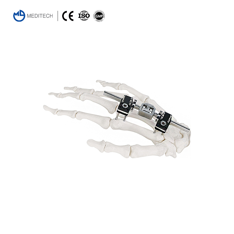 Meditech Mini Fixator Combined Type Orthopedic External Fixator Orthopedic Device Mini Finger and Palm Fixator