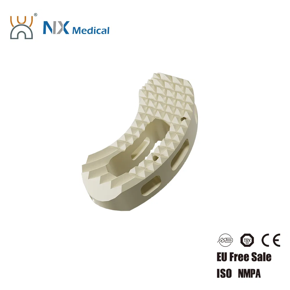 Nx Medical China Factory Titanium Tlif Cage Peek for Lumbar Interbody Fusion