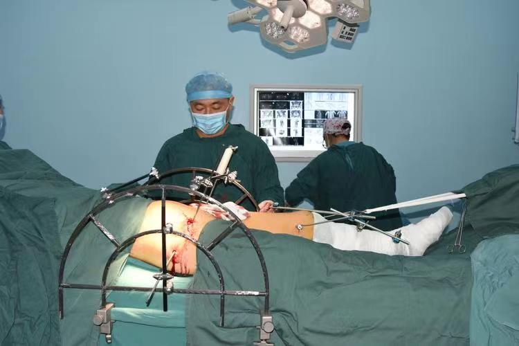 Medical Surgery Orthopedic Pelvic External Fixator Pelvic