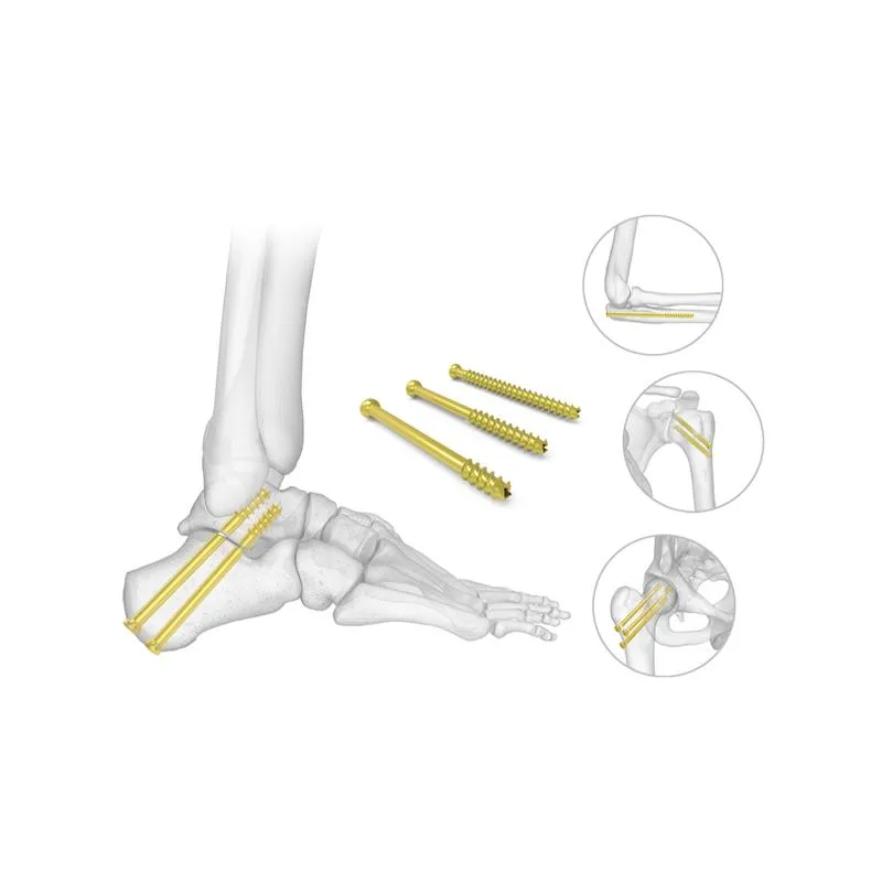 Orthopedic Implants Detail 2