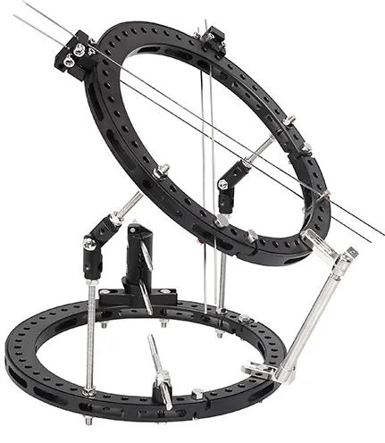 Radiolucent Ring Frame Combination External Fixator