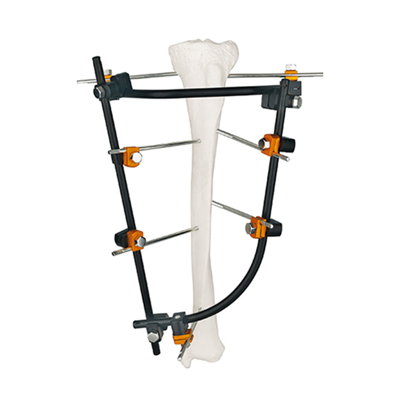 Ao Design Combination Ztype External Fixator for Femur &Tibia