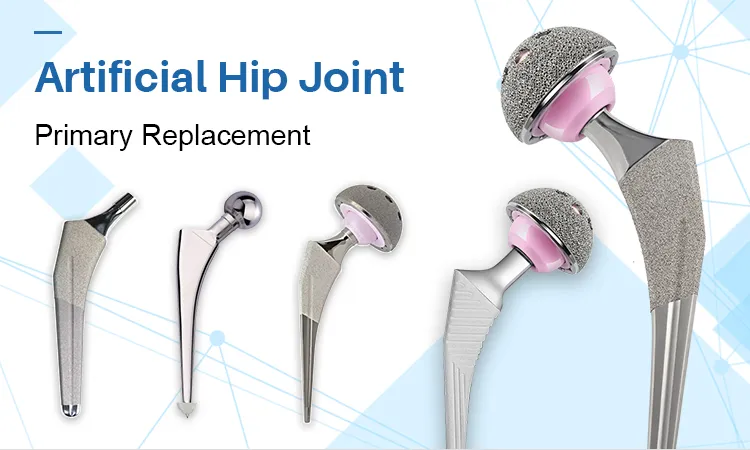 Knee Orthopedic Implants