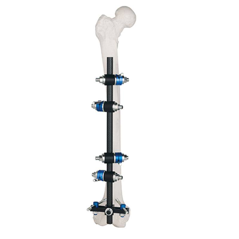 Ao Design Combination Ztype External Fixator for Femur &Tibia