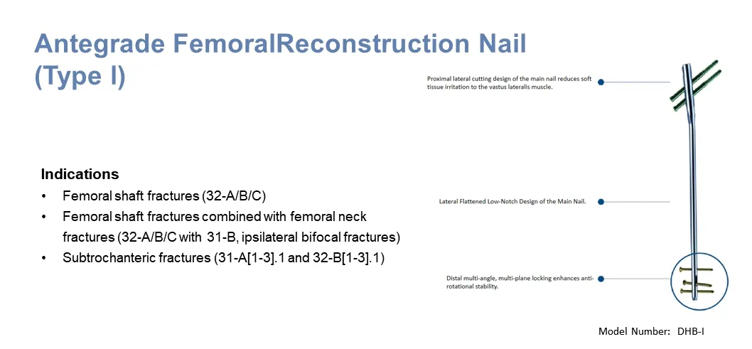 Femoral Intramedullary Nail System