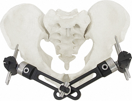 Titanium Bone Fixator Kit in Sleek White and Black