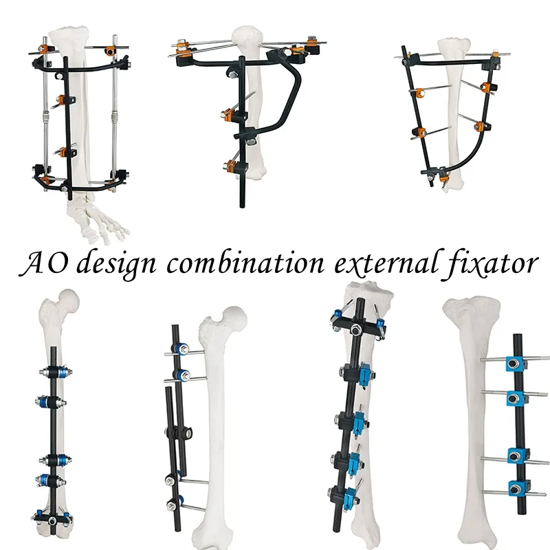 Related Product External Fixator