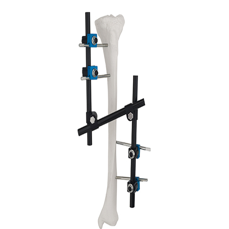 Ao Design Combination Ztype External Fixator for Femur &Tibia
