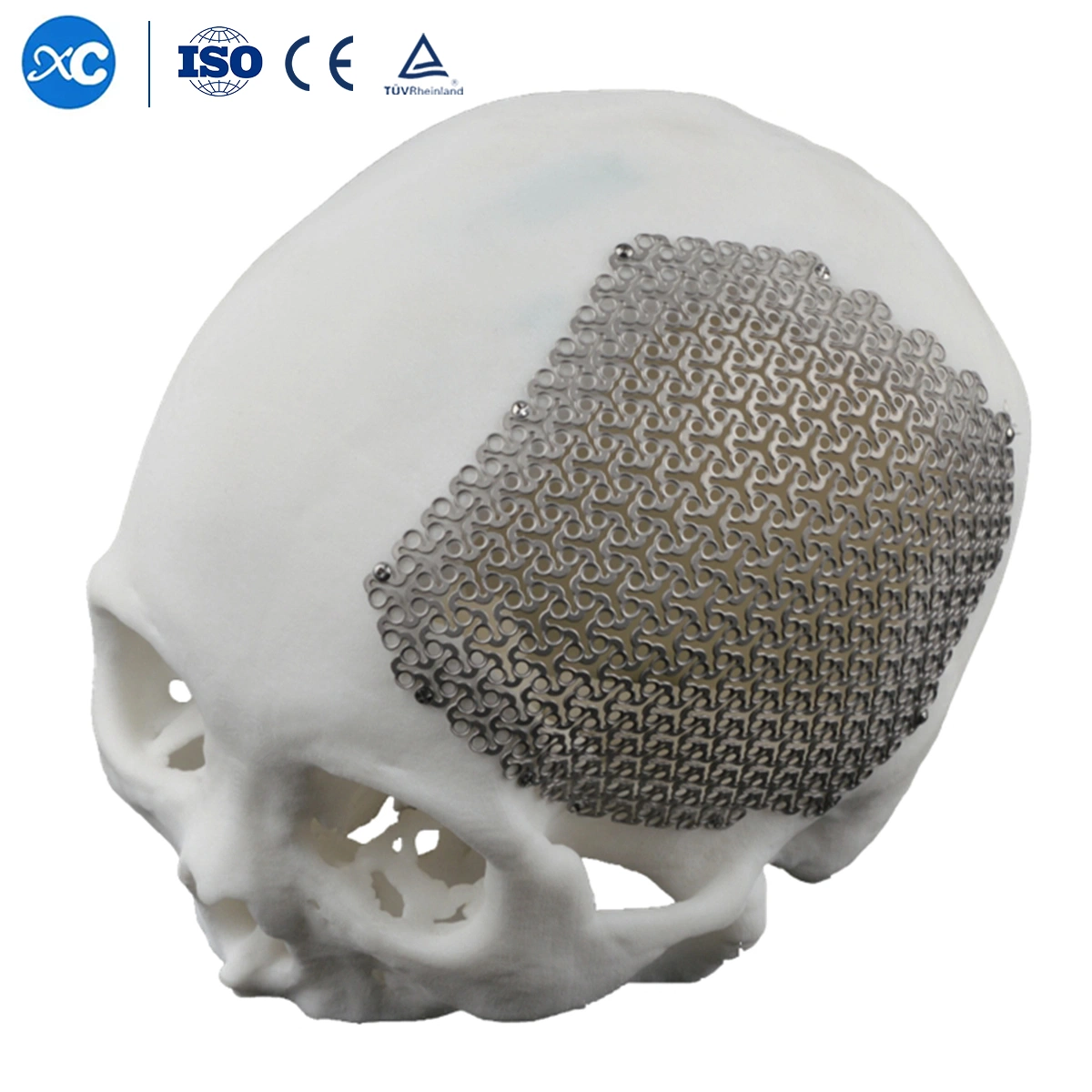 3D Anatomical Cloud Shape Cmf Cranial Mesh Titanium Maxillofacial Implant
