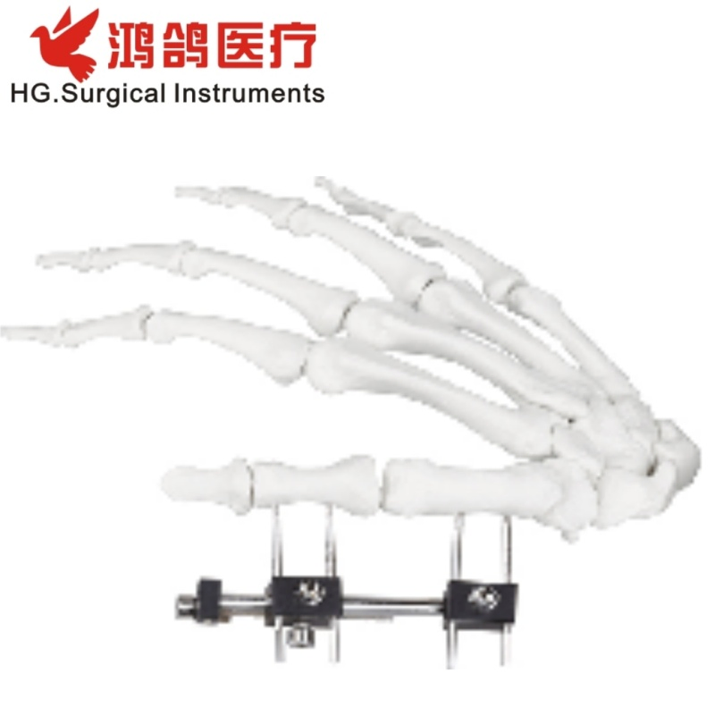 Orthopedic Mini Fixator Joint Motion Type Orthopedic External Orthopedic Products Orthopedic Instrument