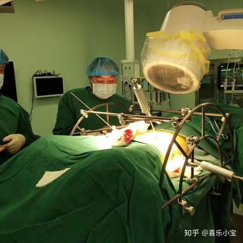 Medical Surgery Orthopedic Pelvic External Fixator Pelvic