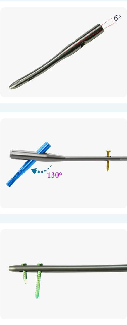 Advantage Illustration