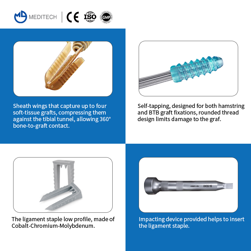 Sports Medicine Tibial Ligament Reconstruction Implants Peek Interference Screw