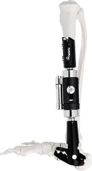 Distal Tibia Fixator