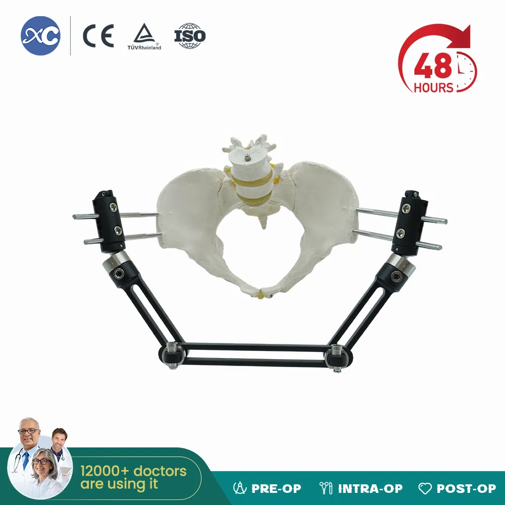 Orthopedic Equipment External Fixator External Fixation of Pelvis and Ankles