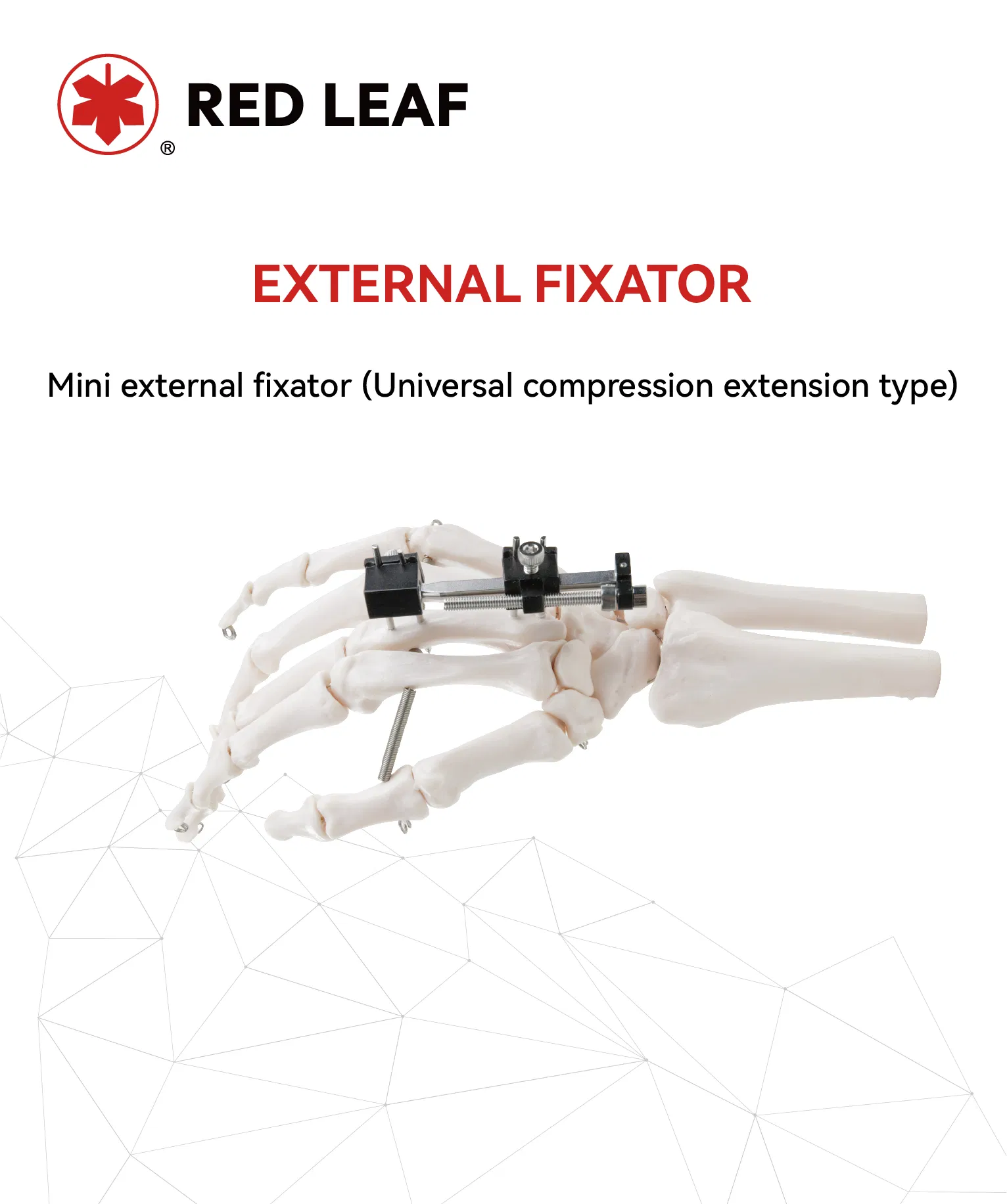 Universal Mini Palm External Fixator