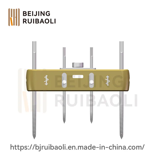 External Fixator Part 3
