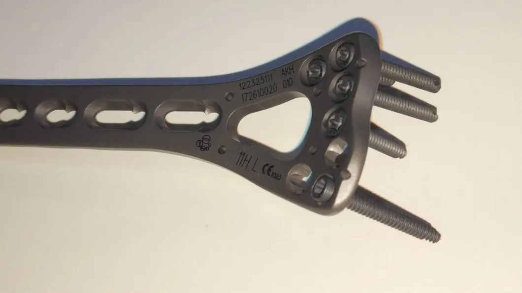 Medical Implant View