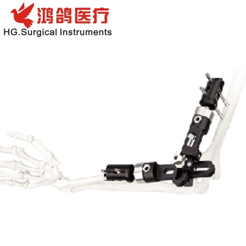 Orthopedic Instrument Elbow Joint External Fixator Knee Joint External Fixator
