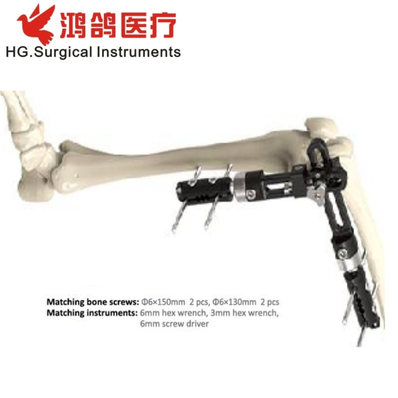 Orthopedic Instrument Elbow Joint External Fixator Knee Joint External Fixator