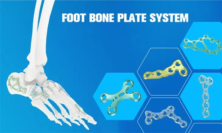 Bone Fixation Device