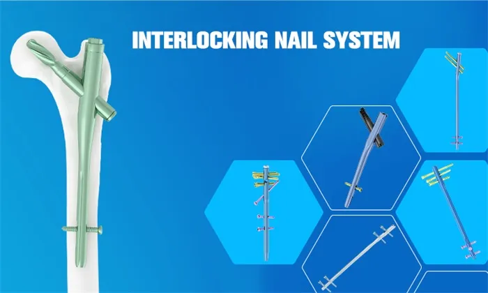 High-Quality Interlocking Nail