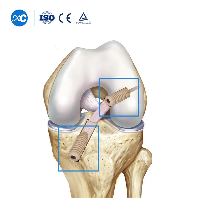 Orthopedic Screws View 2