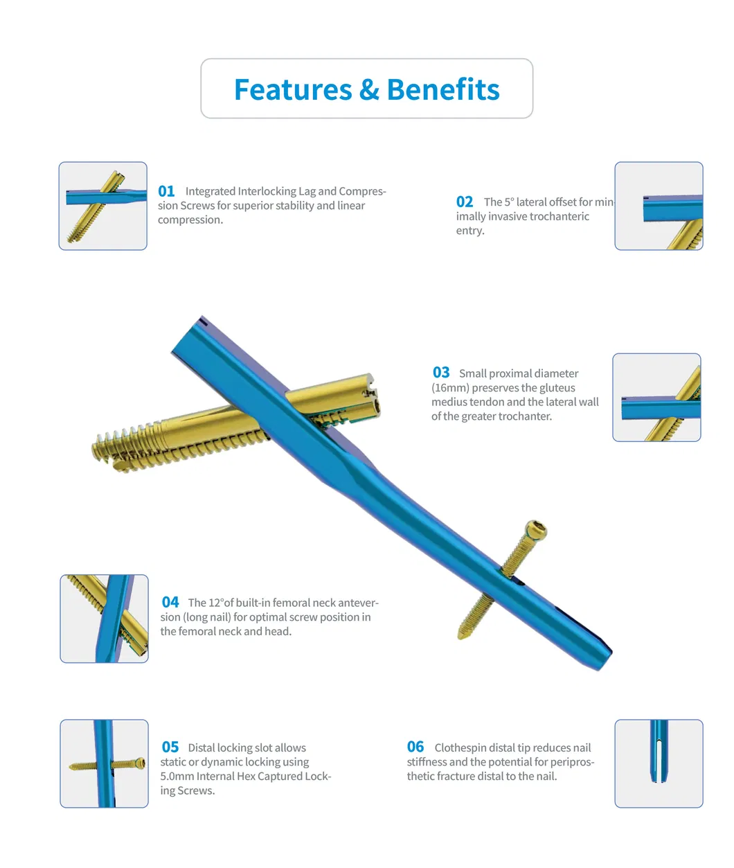 Interlocking Nail Standard 2
